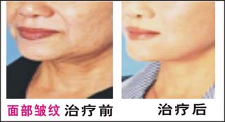 沿